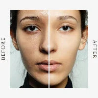 Before and after image showing effects of Inflammation-Focused Anti-Aging Skincare on skin appearance.