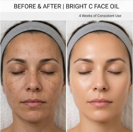 Hyperpigmentation & Brightening