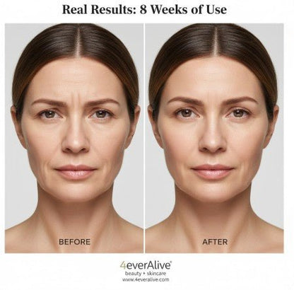 Matrixyl 3000 + HA Complex Serum - 4EverAlive Labs