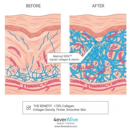 Matrixyl 3000 + HA Complex Serum - 4EverAlive Labs