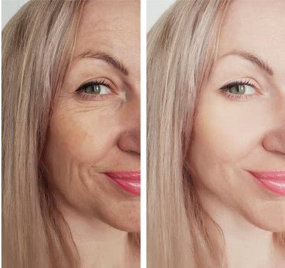 Before and after of Vitamin C Serum with MAP, Niacinamide & Ferulic Acid - from 4everalive Labs 