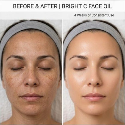 Before and after comparison of a woman's face with bright C face oil showing skin improvement.