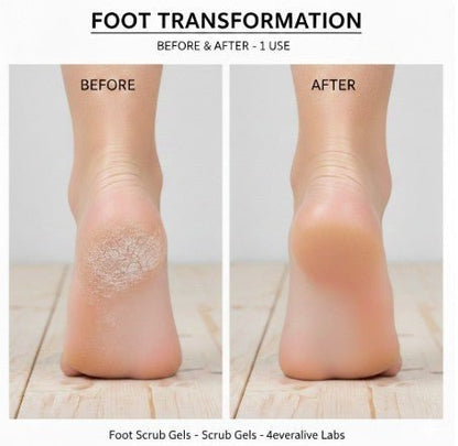 Arnica - Honey Foot Scrub Gel - 4EverAlive Labs