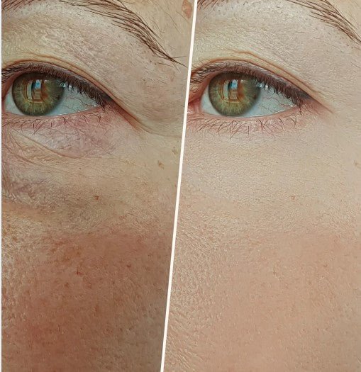 Niacinamide Complex Serum: Advanced Brightening & Barrier Repair - 4EverAlive Labs