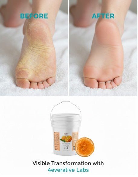 Citrus Foot Scrub Gel |1Gallon | 128 fl.oz. - 4EverAlive Labs